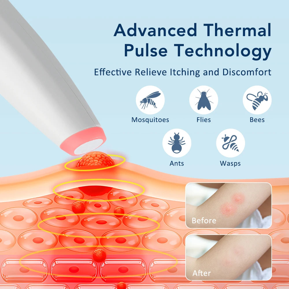 Portable Mosquito Insect Bite Relieve Itching Pen 